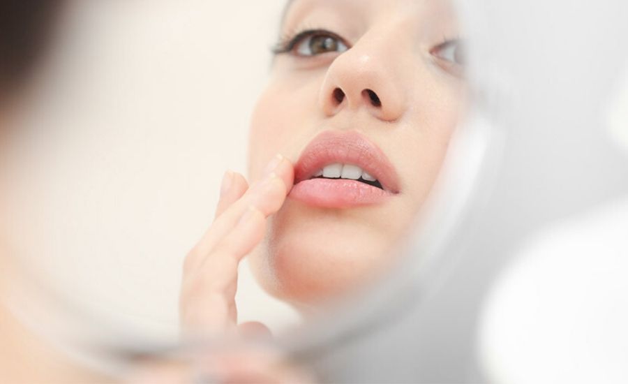 Perfect lip fillers treatment 01, Muse Clinic