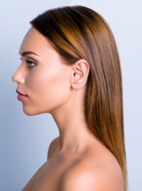 Nose filler model 02-1, Muse Clinic Sydney